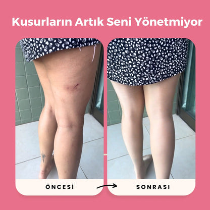 Yumusha™Anti-Selülit Külotlu Çorap
